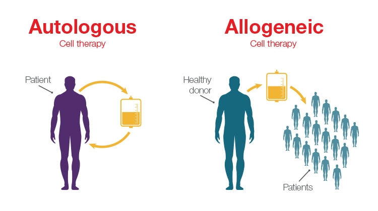 Comparison between autologous therapies and allogeneic therapies